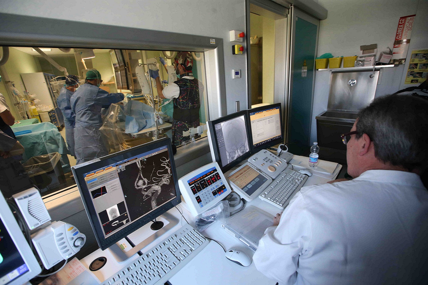 Al San Gerardo l’équipe che cura i tumori cerebrali pediatrici